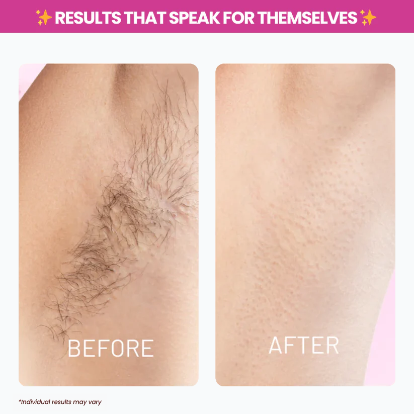 Chicluno™ Cyperus Rotundus Oil