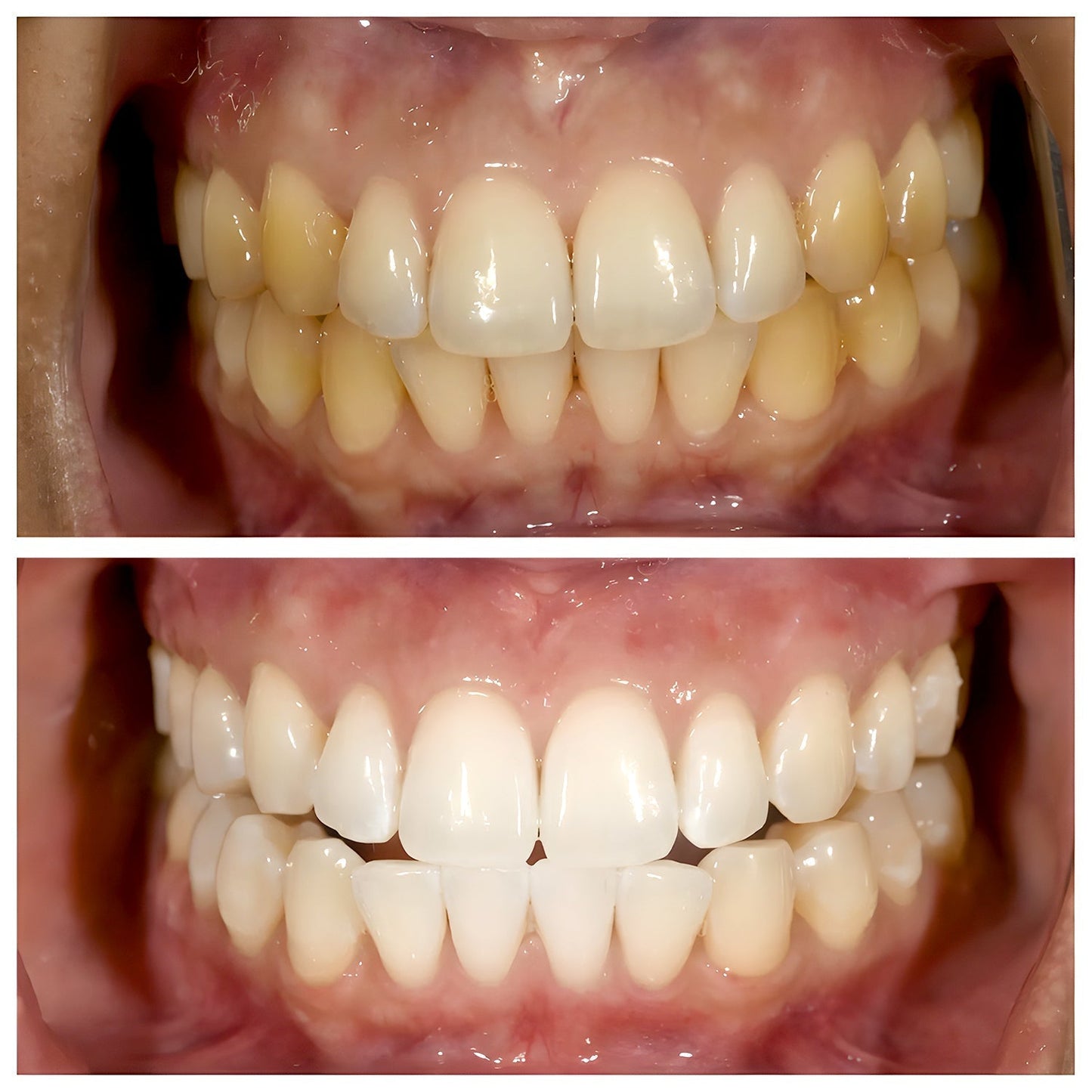 TriBright - ToothPaste