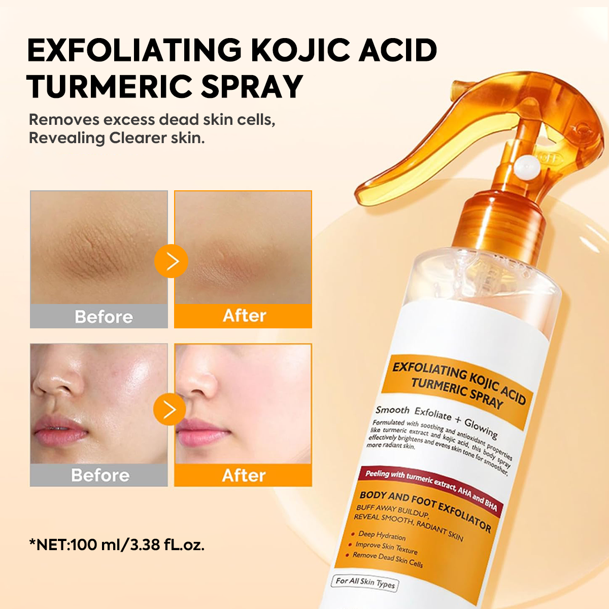🌸 New! Peeling Shot Keratin Care Kojic Acid Turmeric Spray