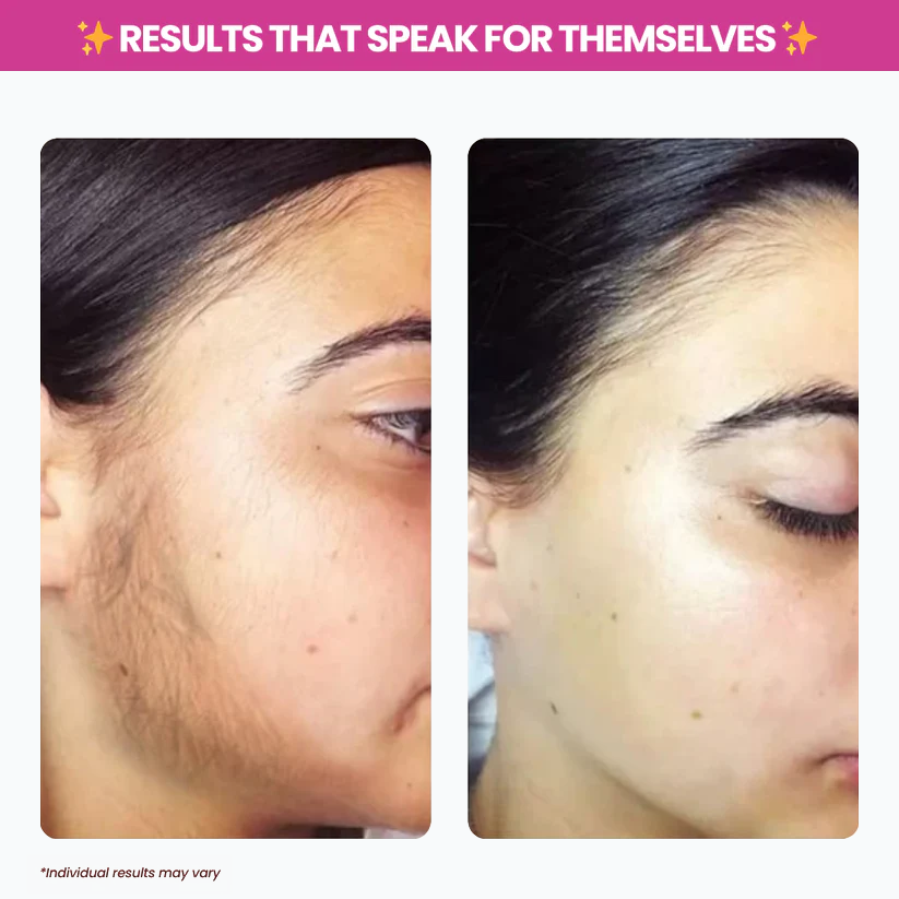 Chicluno™ Cyperus Rotundus Oil