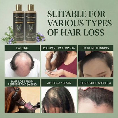 Chicluno™ Growth-Support Shampoo - 2-Pack