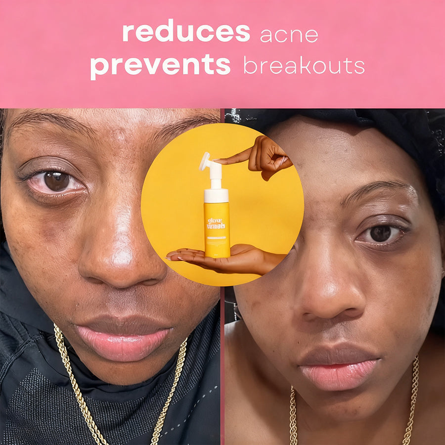 VIRAL Turmeric & Kojic Acid Glow Wash