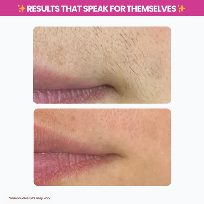 Chicluno™ Cyperus Rotundus Oil