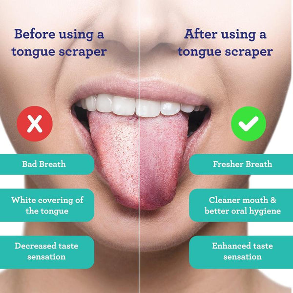 Tongue scraper