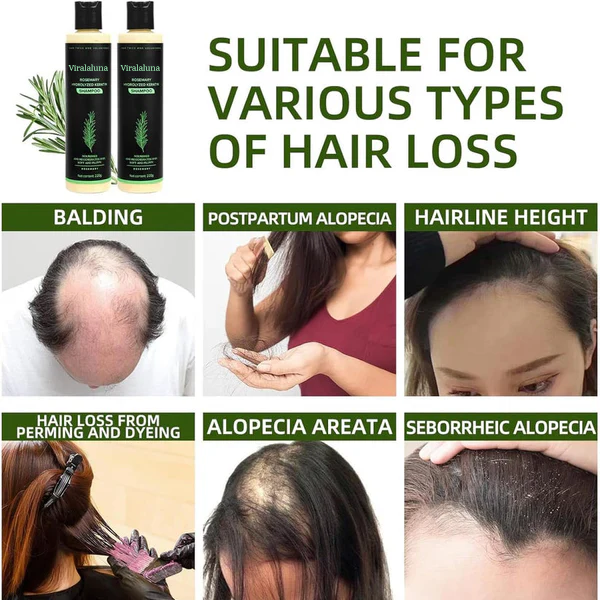 Chicluno Rosemary Shampoo
