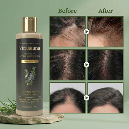Chicluno™ Growth-Support Shampoo - 2-Pack