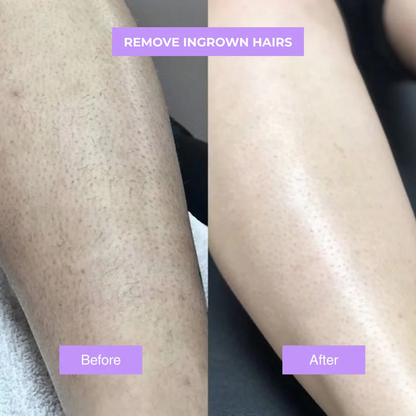 Chicluno™ - Cyperus Rotundus Skin Serum
