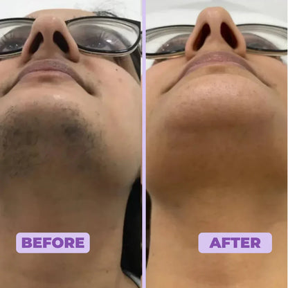 Facial Hair Removal Cream