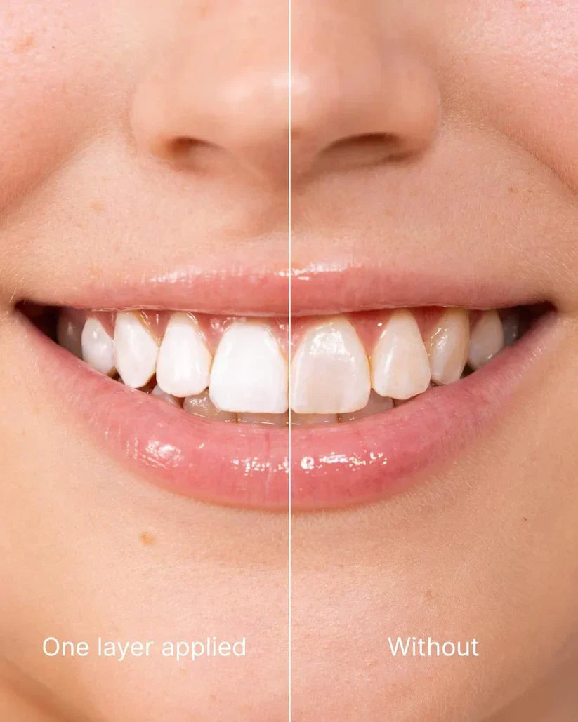 Chicluno™ Tooth Polish