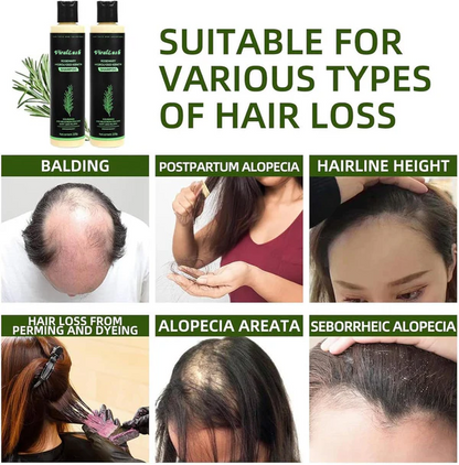 Chicluno Rosemary Shampoo