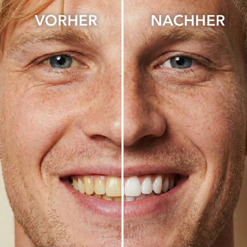 Chicluno™ Tooth Polish