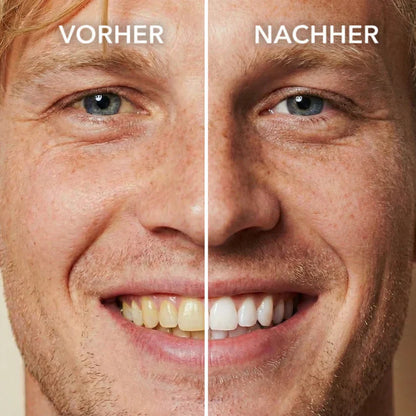 Chicluno™ Tooth Polish