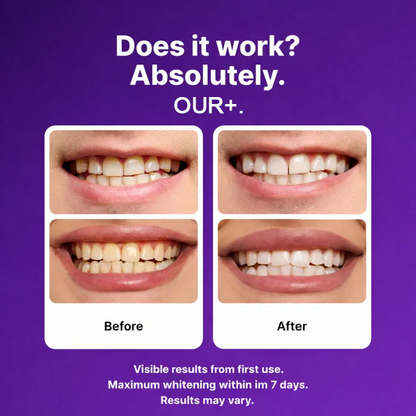 OUR+™ Color-Correct Whitening Strips