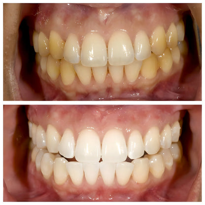 TriBright - ToothPaste