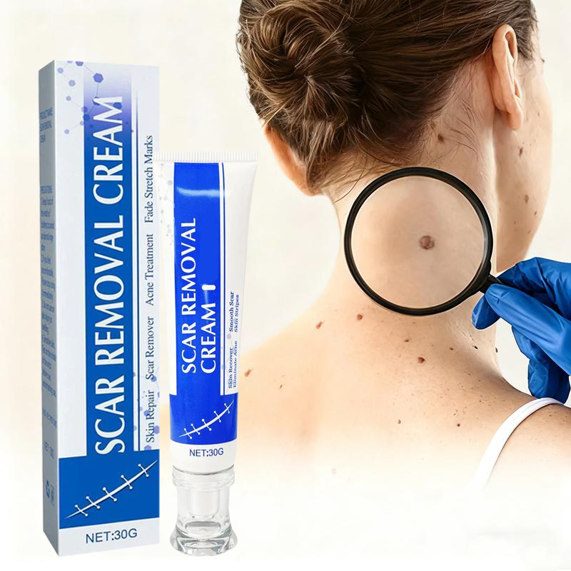 Chicluno Scar Removal Cream