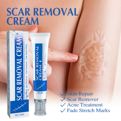 Chicluno Scar Removal Cream
