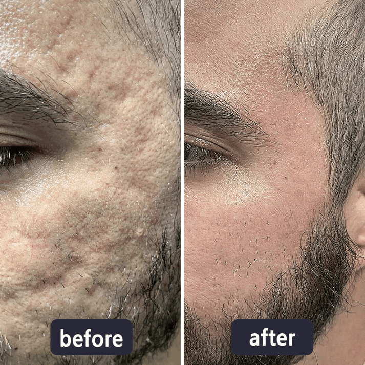 Chicluno Scar Removal Cream